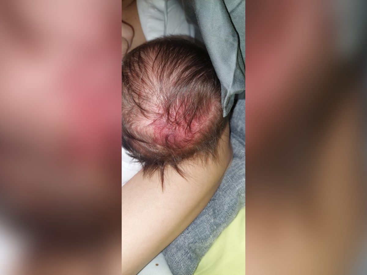 Γιατί Τα Μωρά Γεννιούνται Με Τρίχωμα; Απίστευτα Γεγονότα!